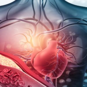 Human heart with blocked arteries. 3d illustration