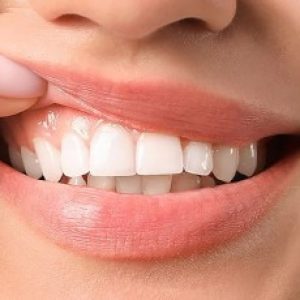 Having itchy gums – These could be the reasons, take care!!