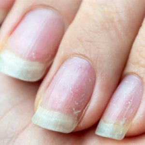 Do you know – The issue of weak nails can be due to the lack of these important nutrients!!