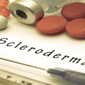 Scleroderma, an autoimmune issue – Important things to know!!