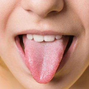 Different types of tongue colour would reveal about these health issues, take care!!