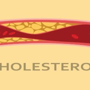 Relationship between yellow coloured growths on the eyelids and heart attacks etc – A simple method to treat high cholesterol levels at home!!