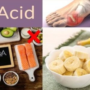 List of various health problems we can get if we have high uric acid, take care!!