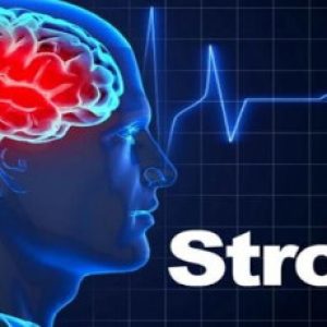 Why these days many young & middle aged adults get strokes more than others?